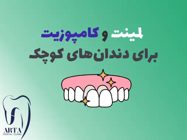 لمینت و کامپوزیت برای دندانهای کوچک